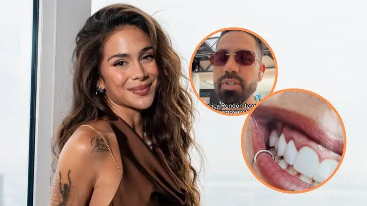 Odontólogo alerta sobre dientes de Greeicy: “Tiene infección”